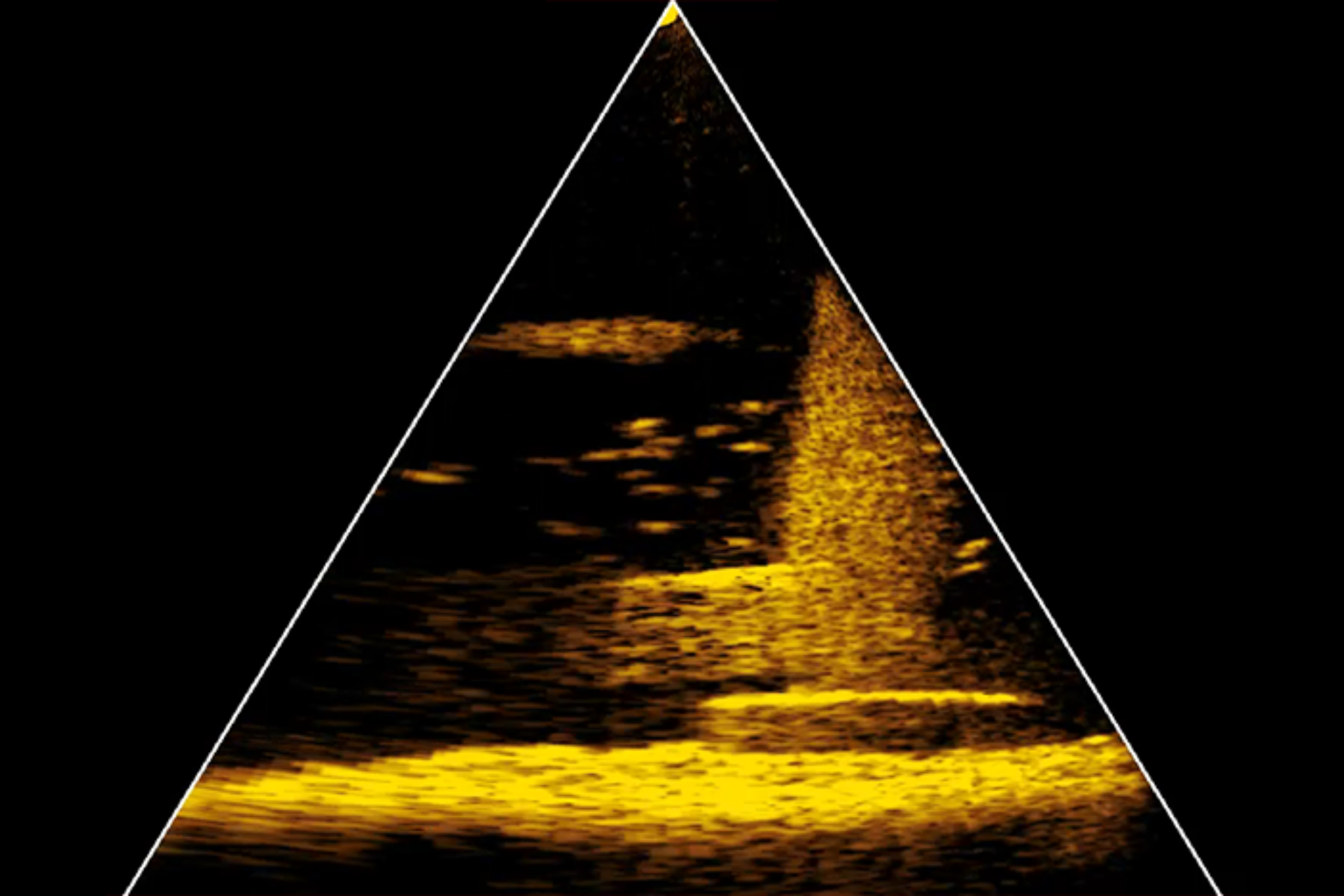 Live Sonar - вид вниз